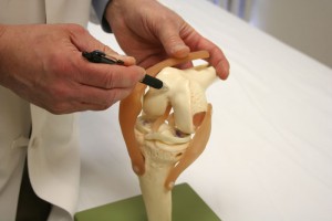 David Diduch, MD, points out the knee joint that loses cartilage, causing pain.