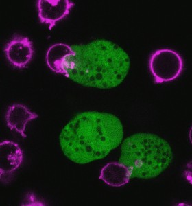 Amoebic trogocytosis eating T cells