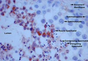 Male contraceptive research has found key enzymes.