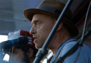 David Sickmen of The Hackensaw Boys had hoarseness and needed vocal polyp surgery