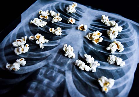 The Lessons of Popcorn Lung: Inhale With Caution