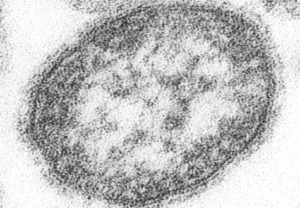 A microscopic image of a single measles virus particle.
