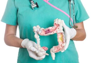 nurse holds 3D model of colon
