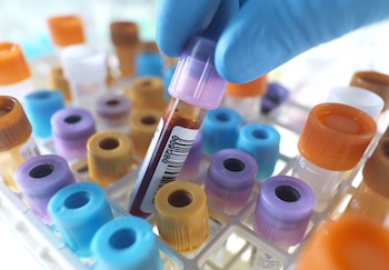 Person selecting a blood sample, close up