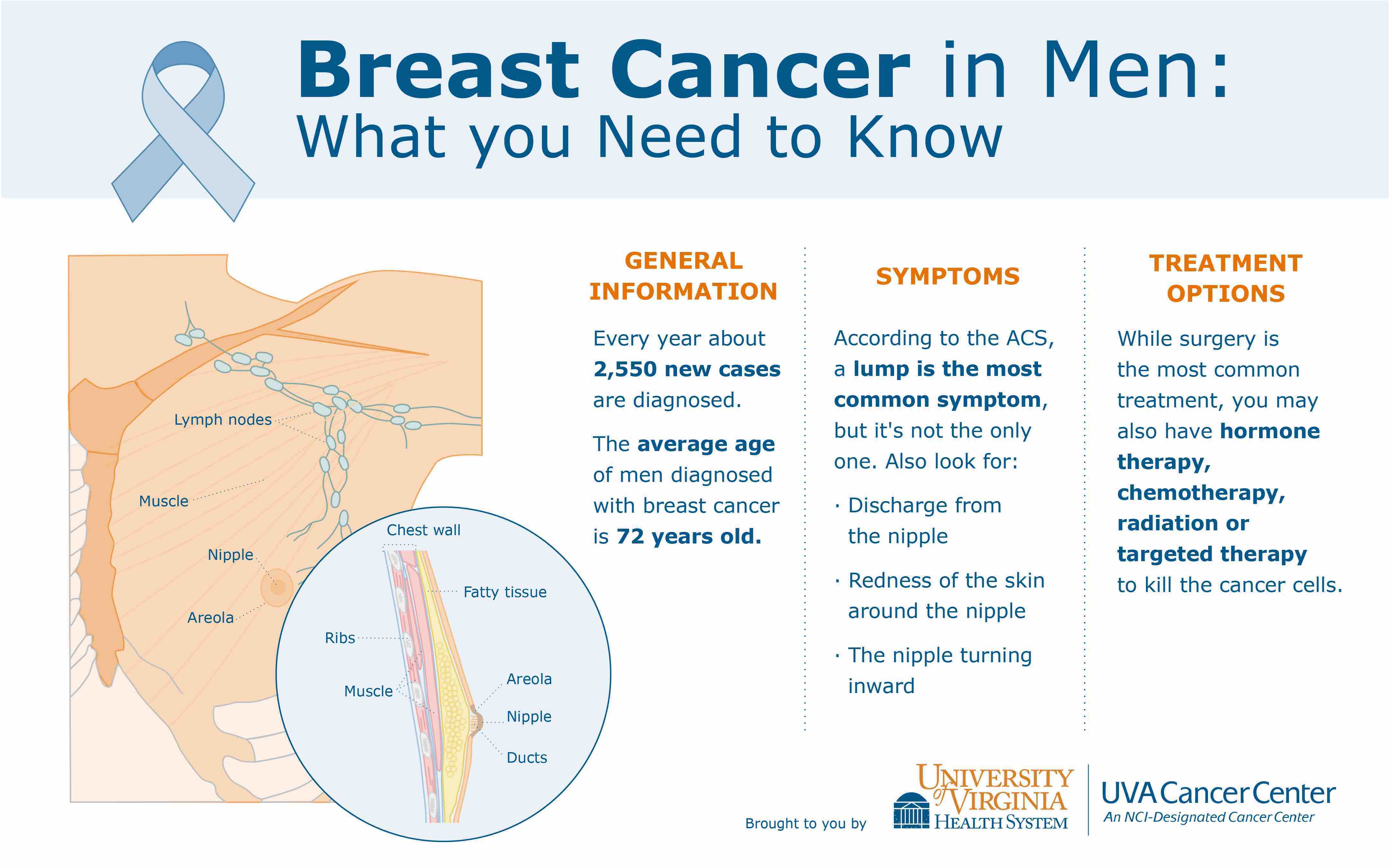 breast cancer in males symptoms