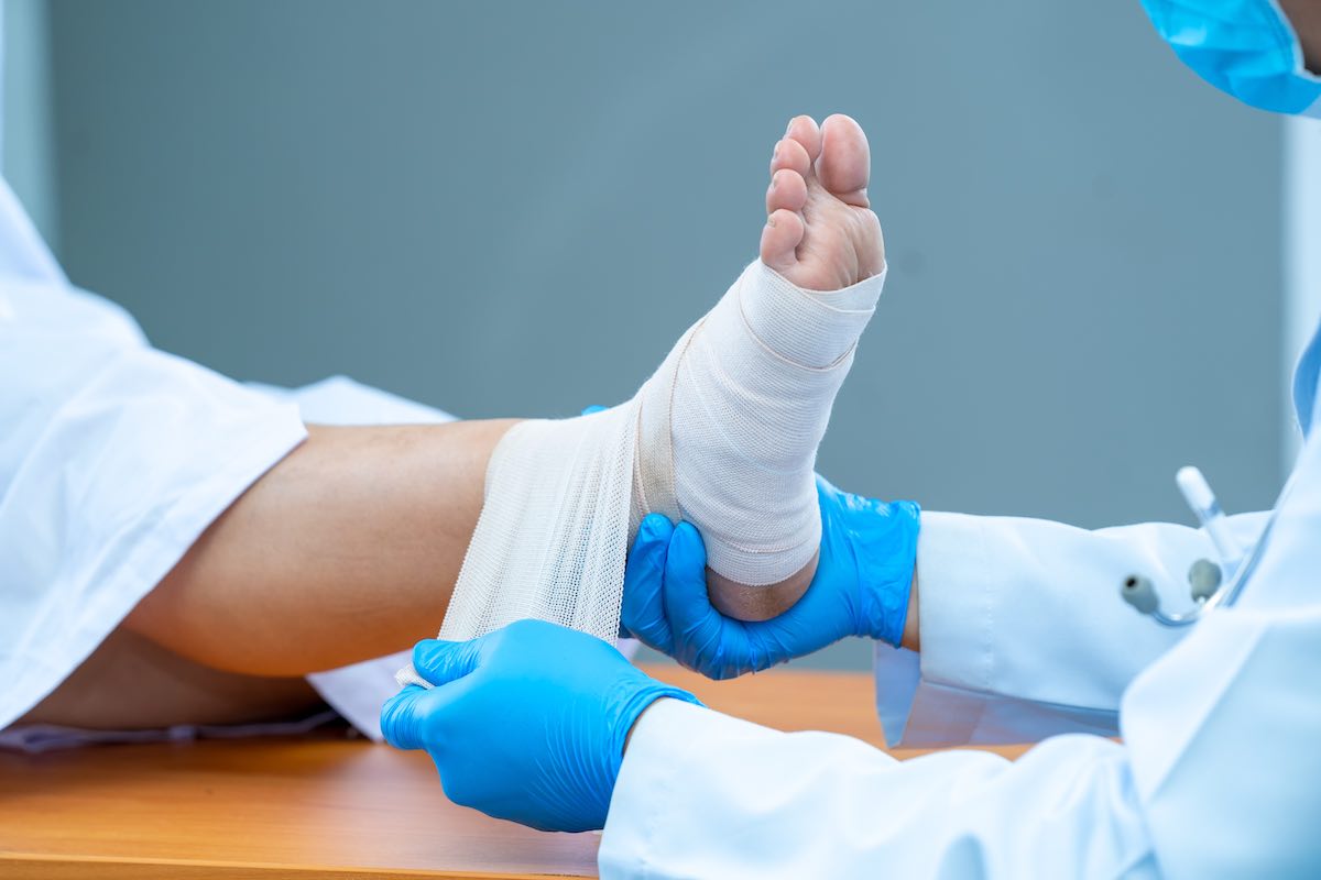 Sprained Ankles: Symptoms, Treatment & More - The Orthopedic Clinic