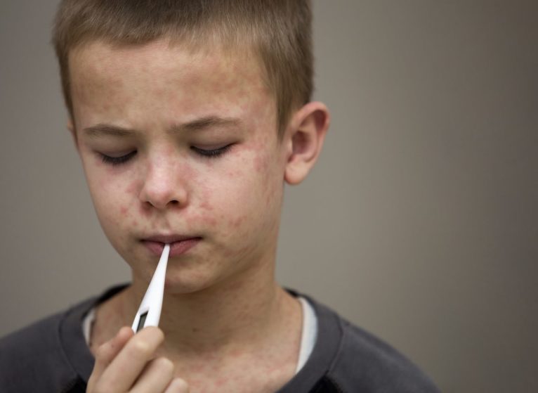 parents not vaccinating more kids with measles