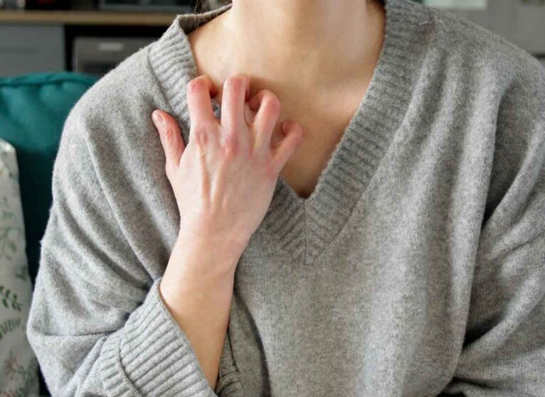 woman scratching her neck because of an eczema flare up