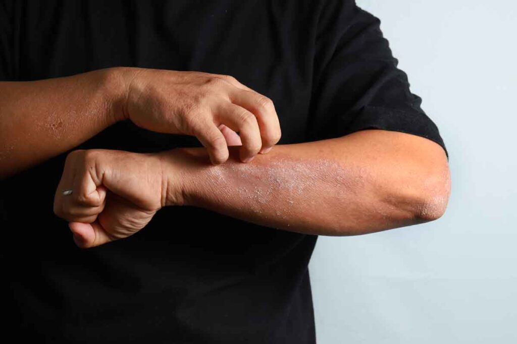 man wondering if his itchy skin is cancer