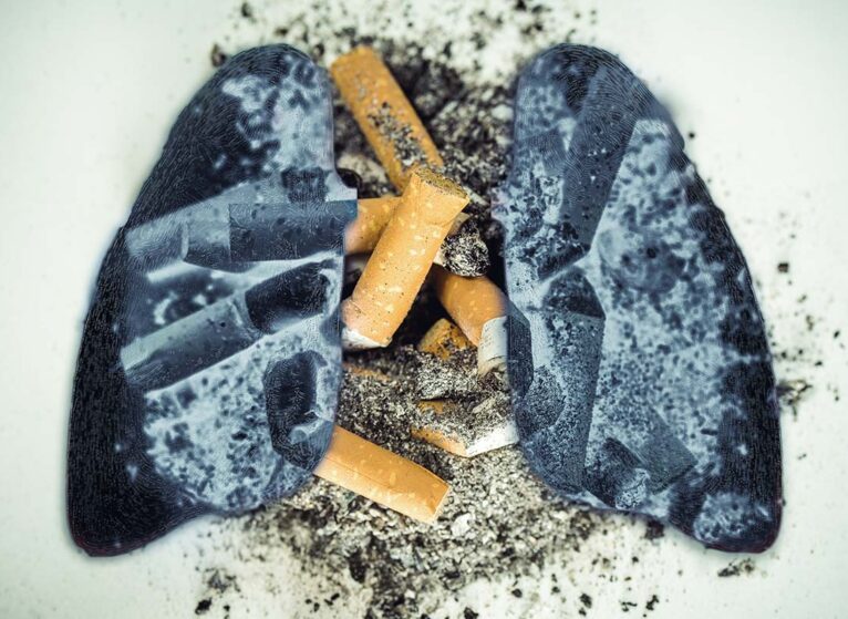 image of charred lungs overlayed on an ash tray with cigarettes