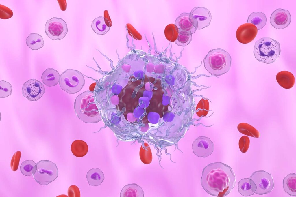 Illustration of neuroendocrine cancer