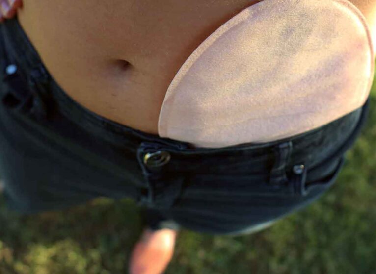What is ostomy? A colostomy in a pair of jeans