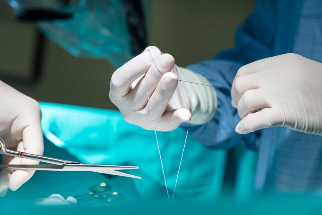 Medical stitches like these can use different materials.